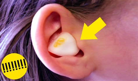 Comment traiter une oreille infectée par une boucle d'oreille.